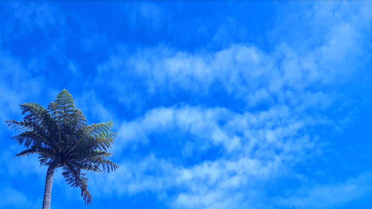 Sunburn