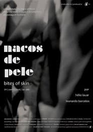Nacos de pele