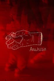 Avulsion