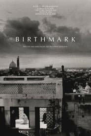 Birthmark