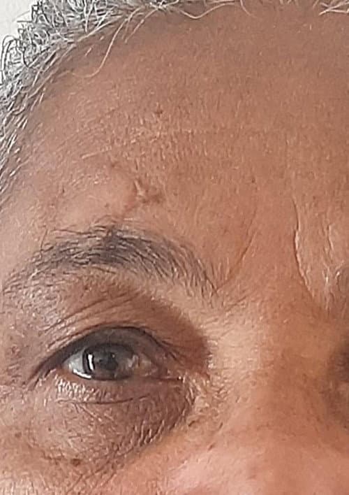 Alternativas Felizes Para Quando o Sol Não Vem