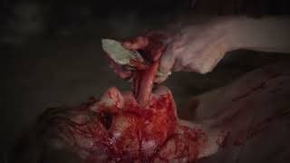 ROMANCE POST-MORTEM - TEASER - EXTREME!!!