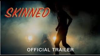 SKINNED | Official Trailer - HD