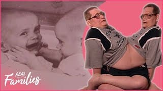 Nurture: Uniquely United - The Galyon Conjoined Twins |Real Families